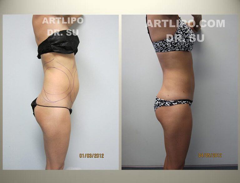 patient photo