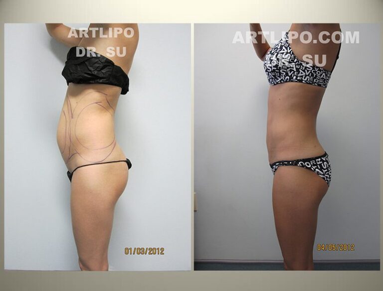 patient photo