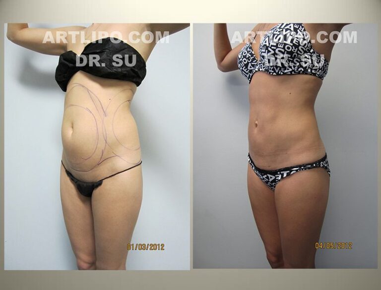 patient photo