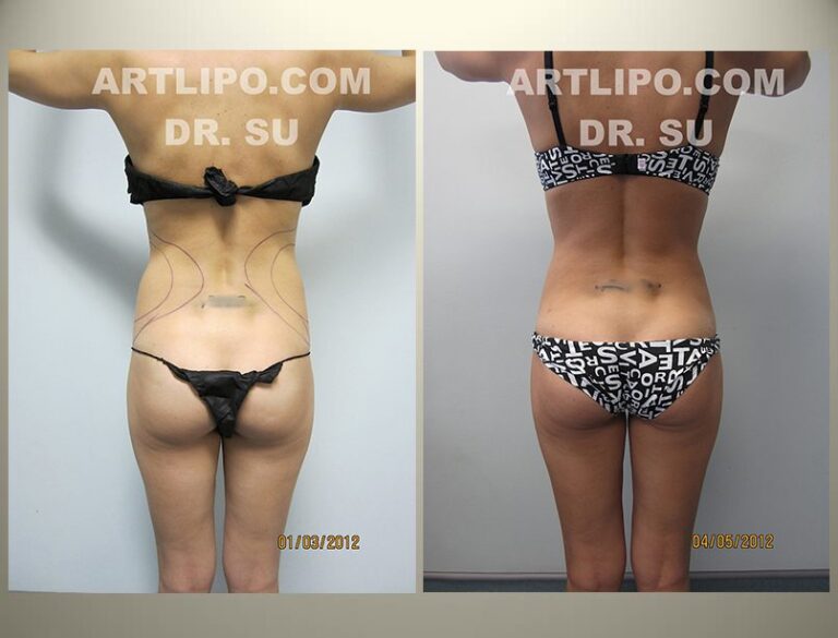 patient photo