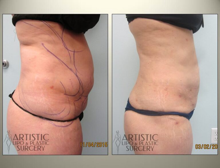 patient photo