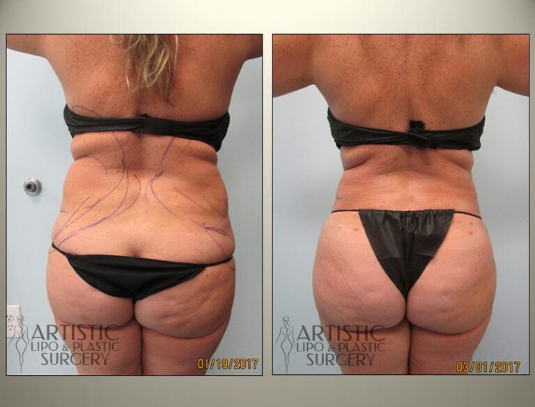 patient photo