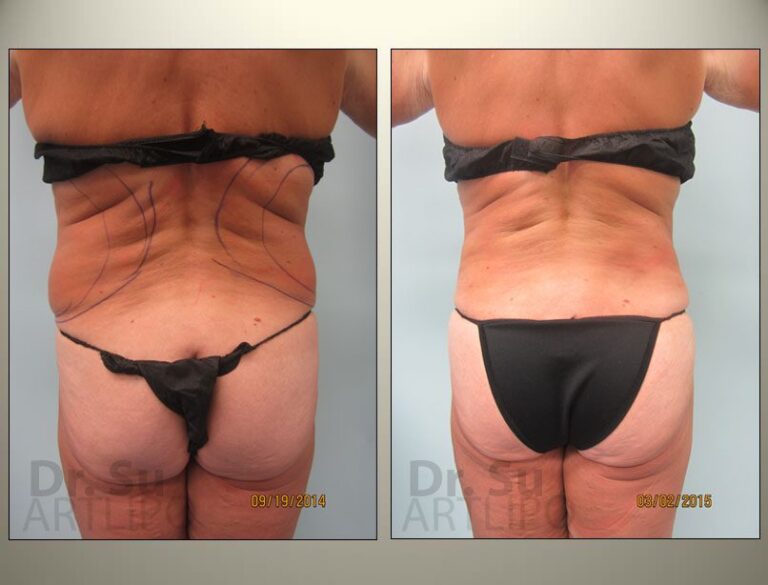 patient photo