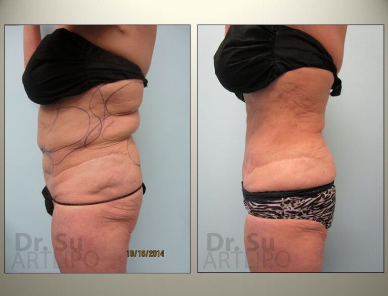 patient photo