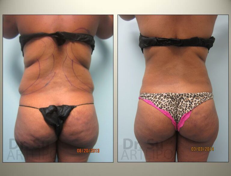 patient photo