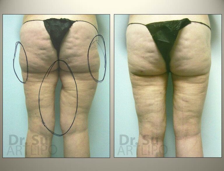 patient photo