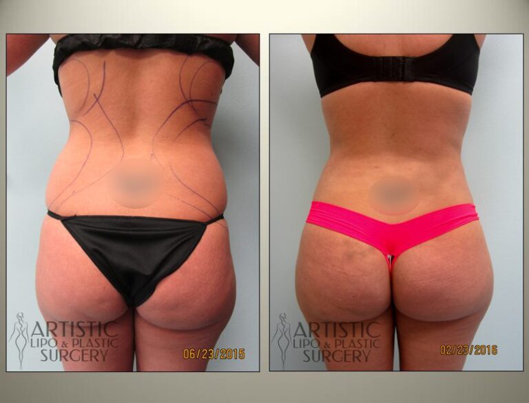 patient photo