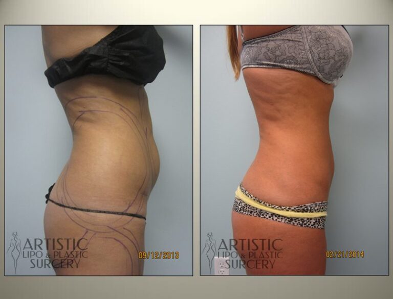 patient photo