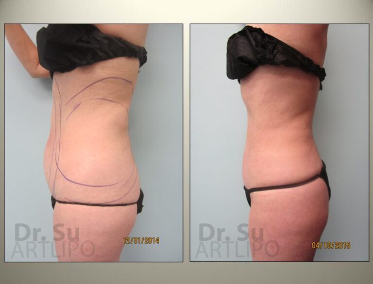 patient photo