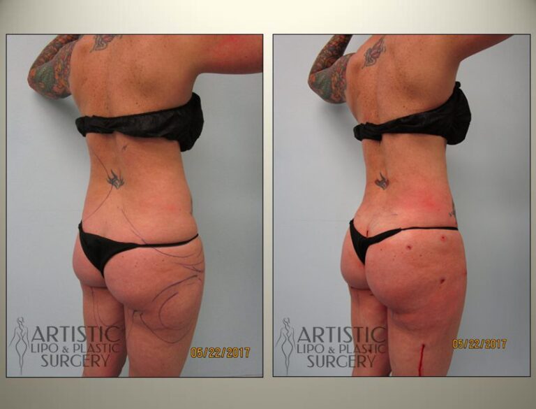 patient photo