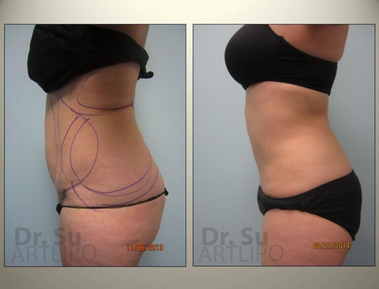patient photo