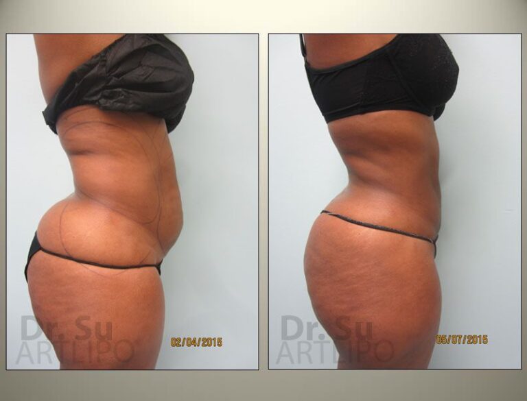 patient photo