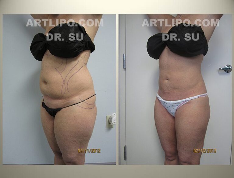 patient photo