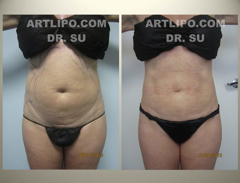 patient photo