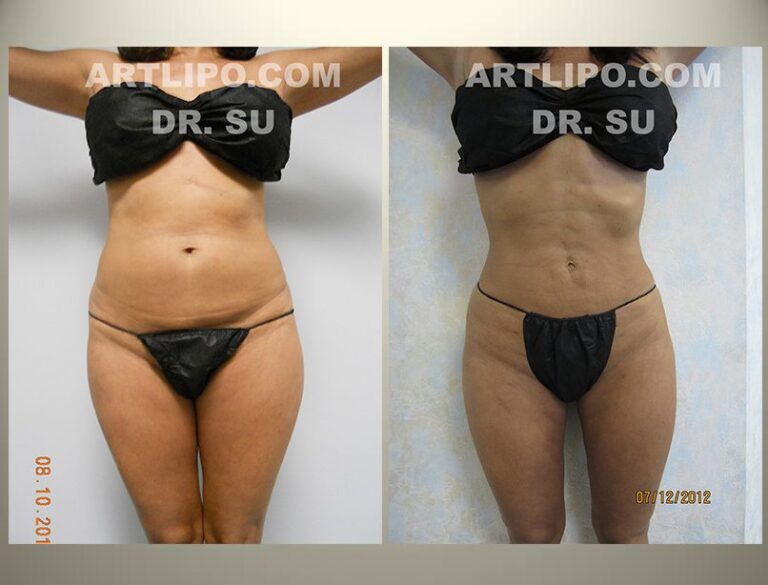 patient photo