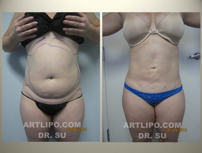patient photo
