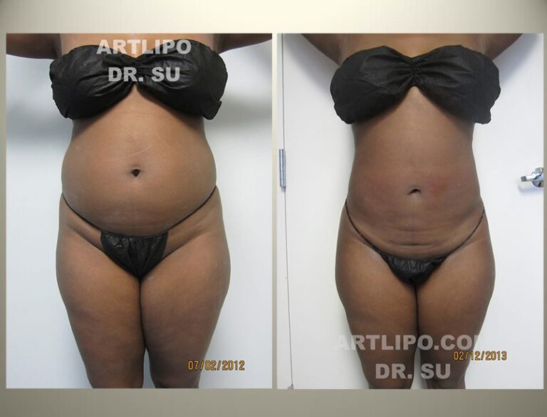 patient photo
