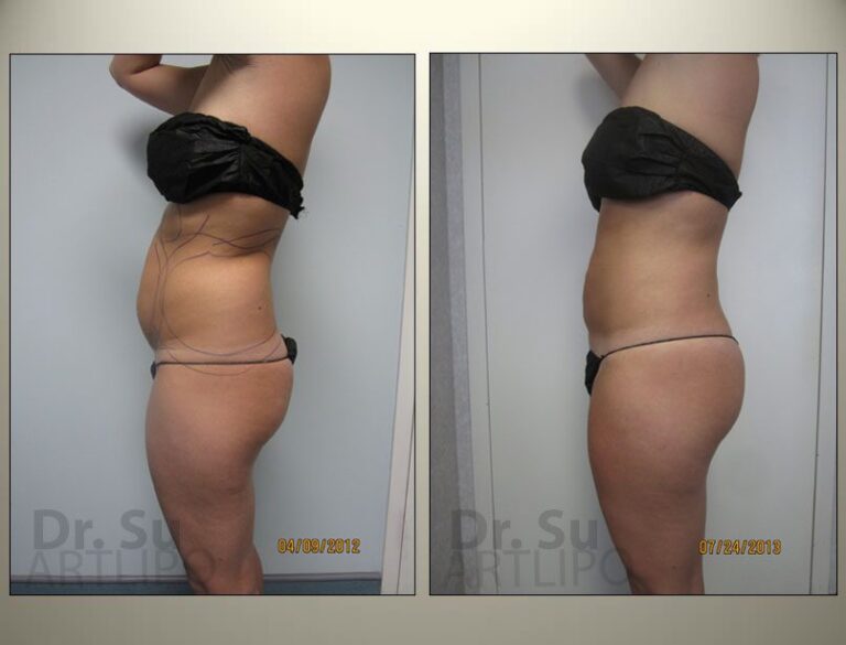 patient photo
