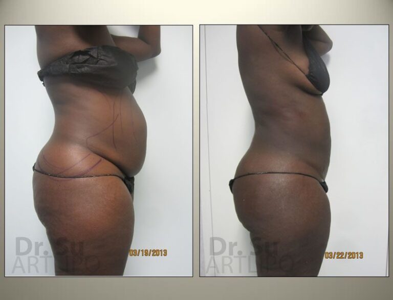 patient photo