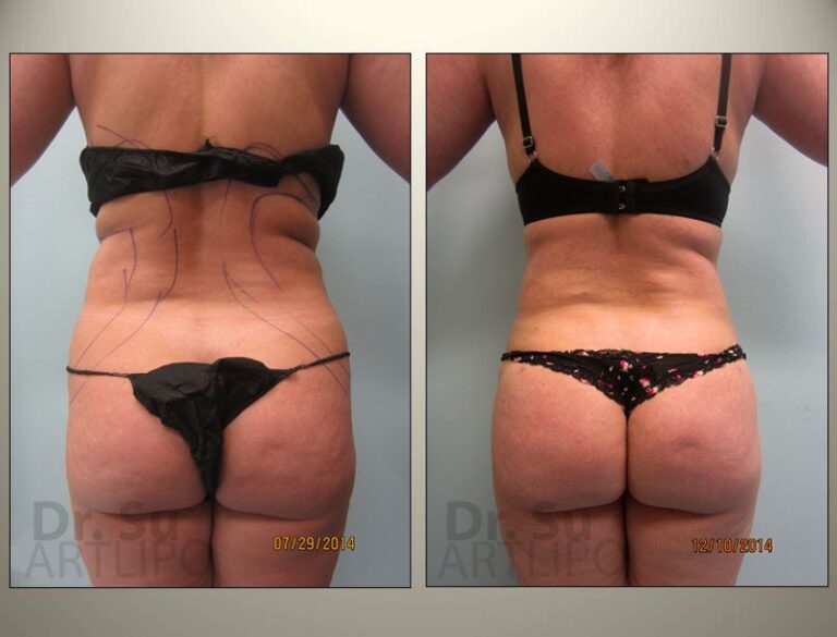 patient photo