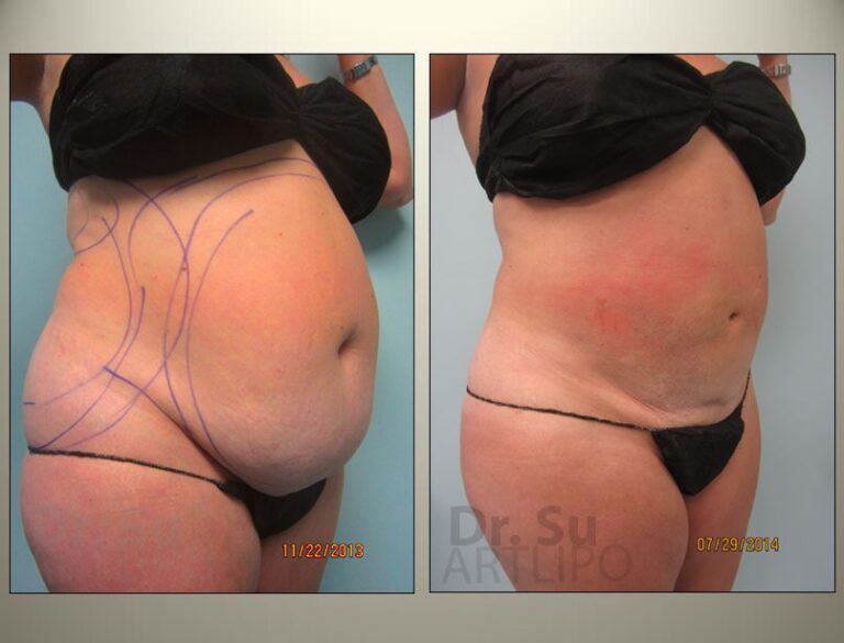 patient photo