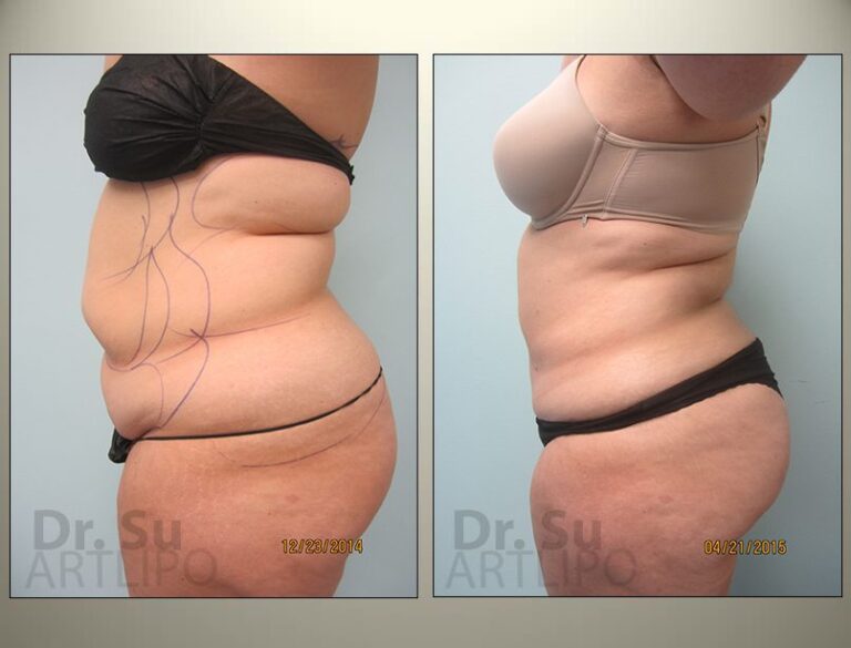 patient photo