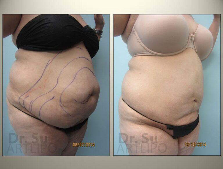 patient photo