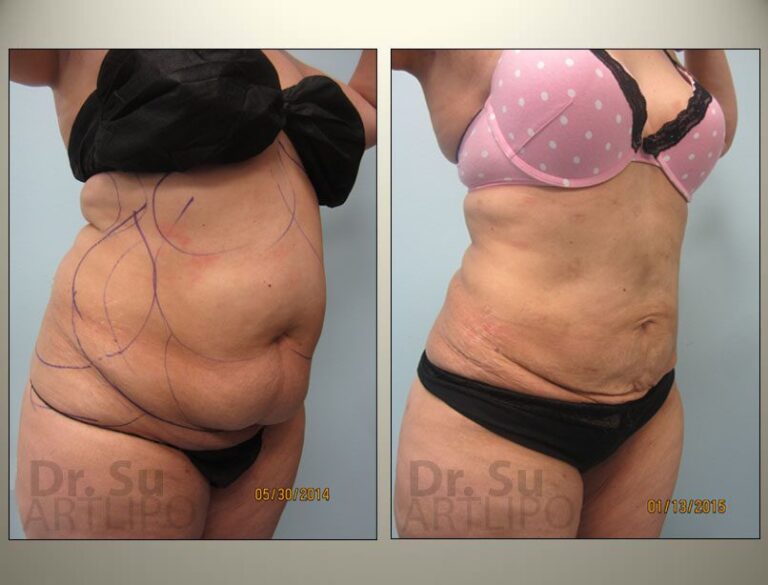 patient photo