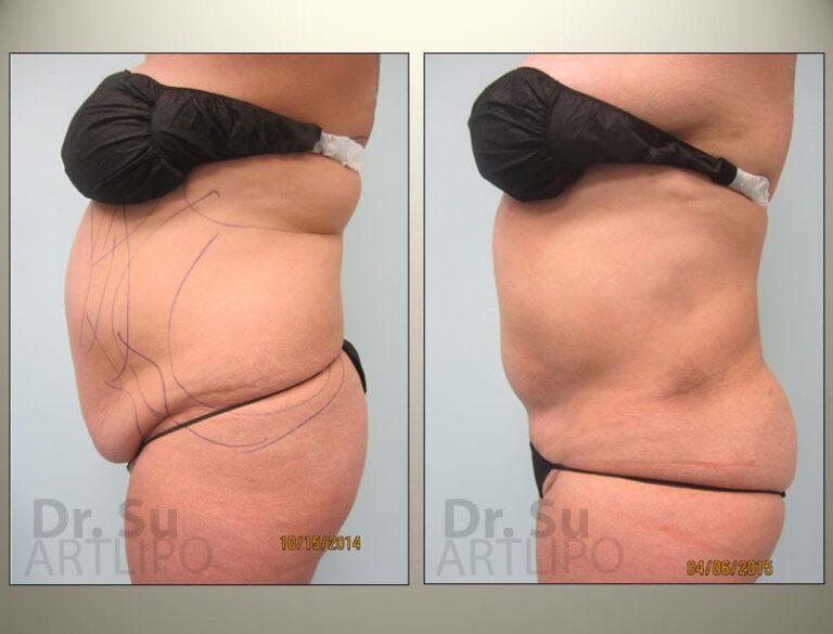 patient photo