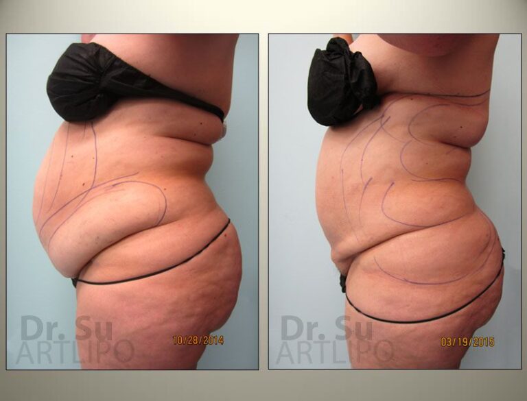patient photo