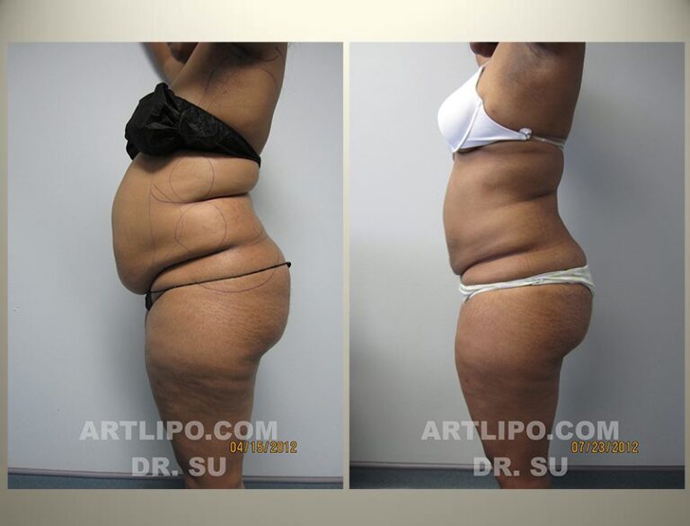 patient photo