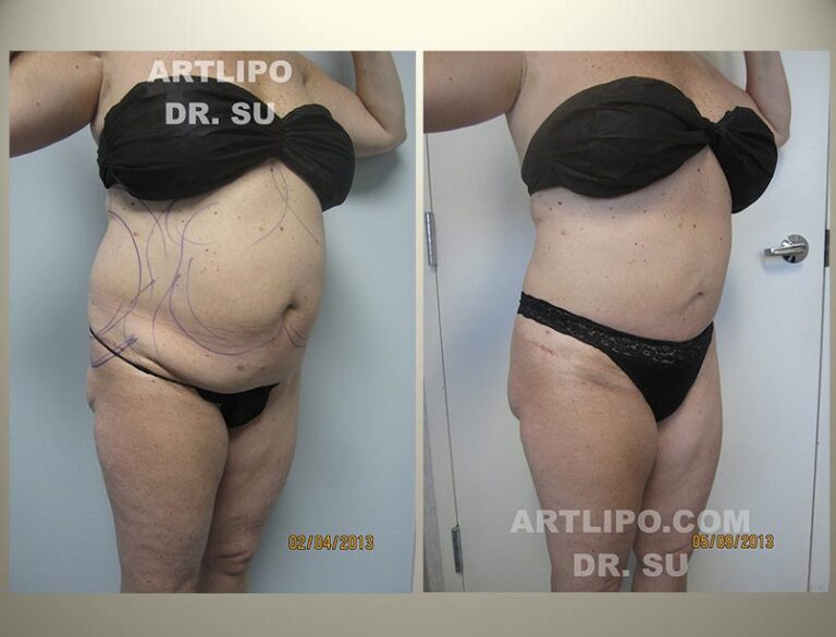 patient photo