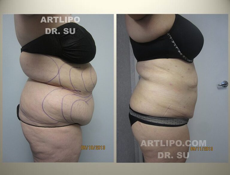 patient photo