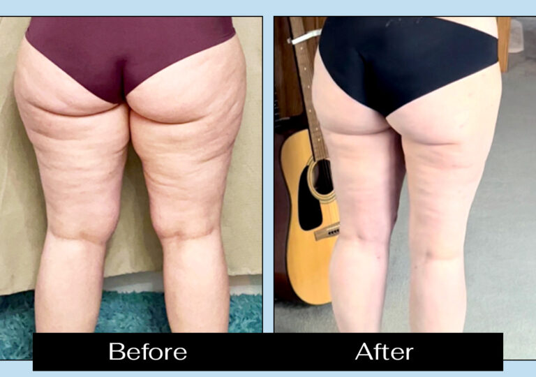 patient photo