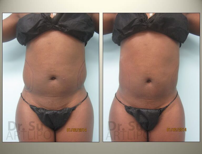 patient photo