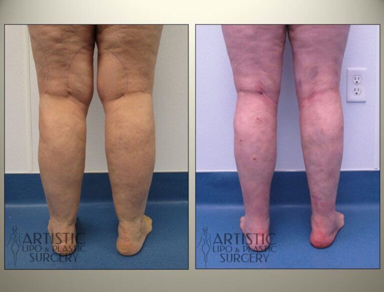 patient photo