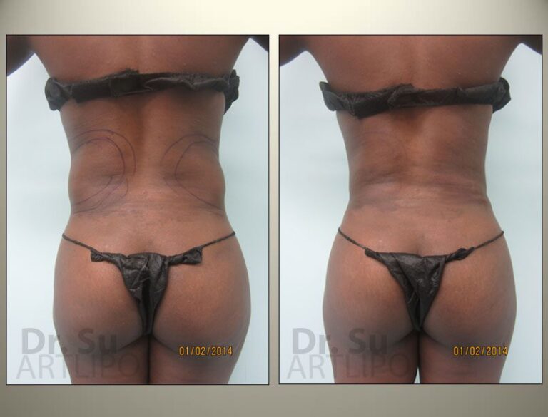 patient photo