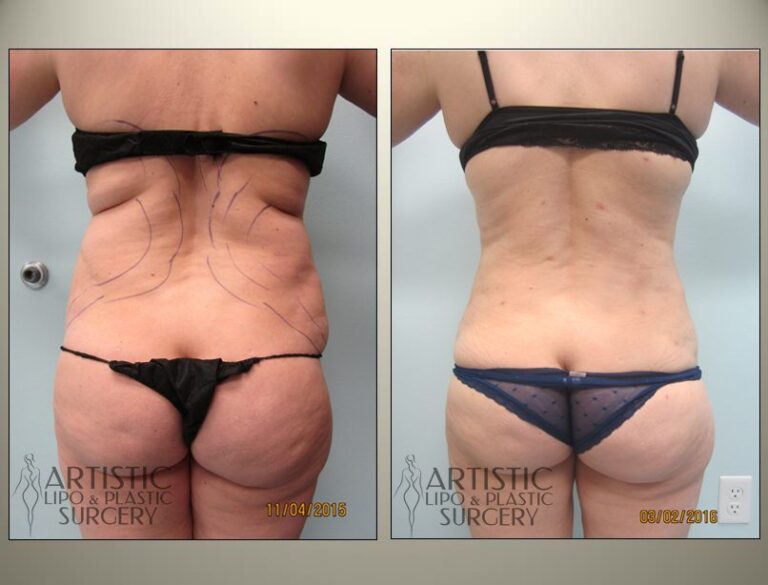 patient photo