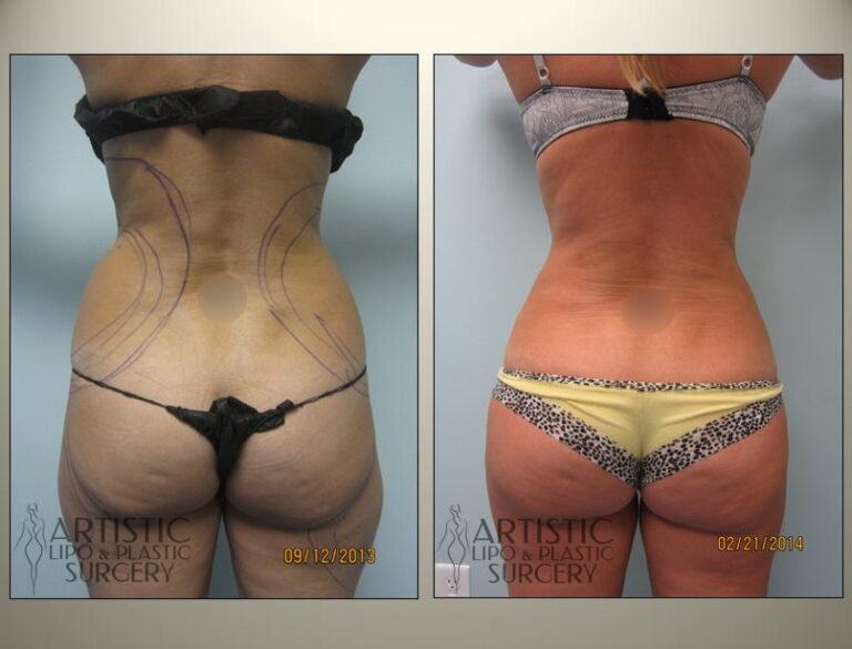 patient photo