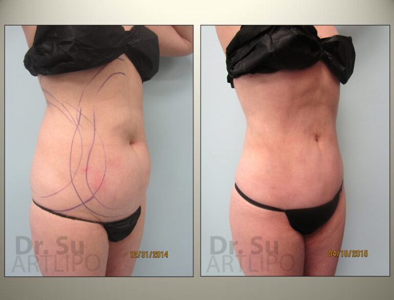 patient photo