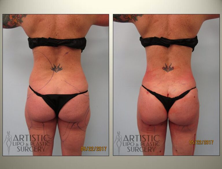 patient photo