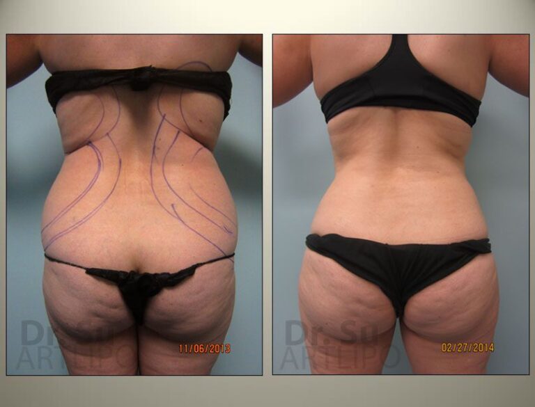 patient photo