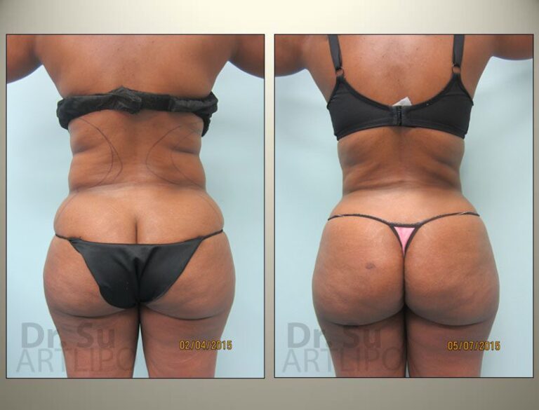 patient photo