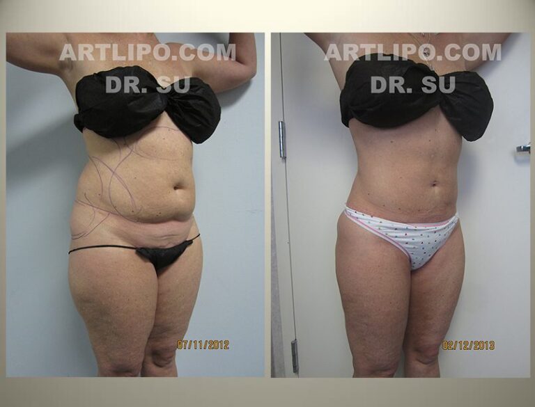 patient photo