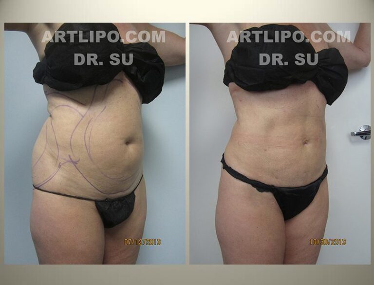 patient photo