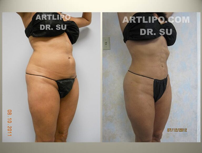 patient photo
