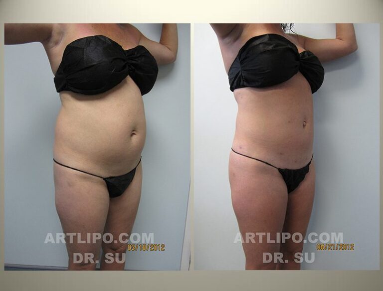 patient photo