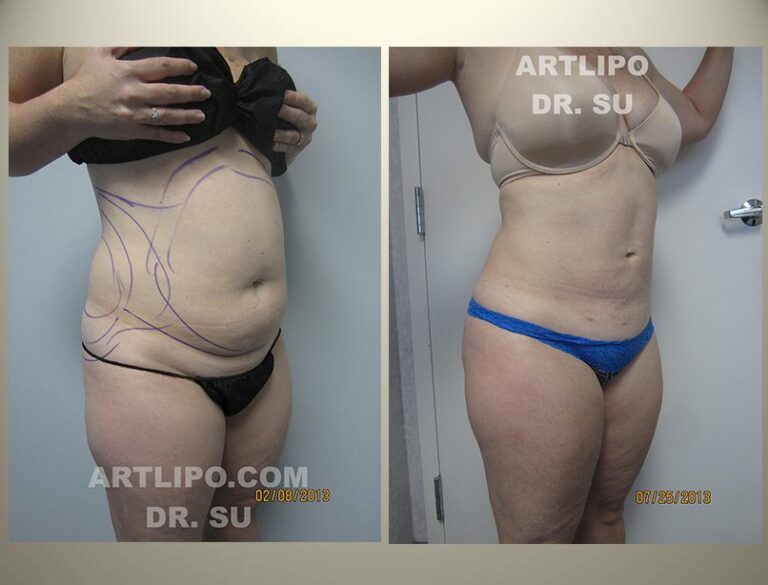 patient photo