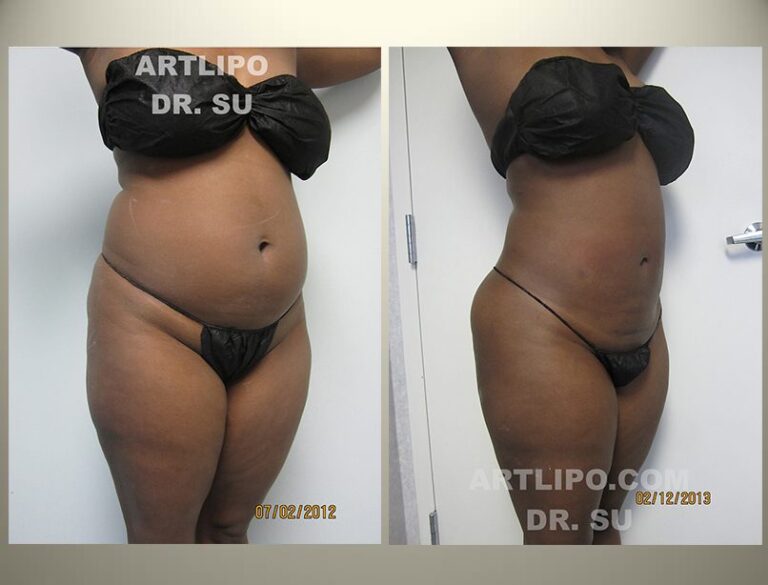 patient photo