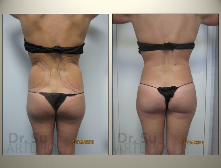 patient photo